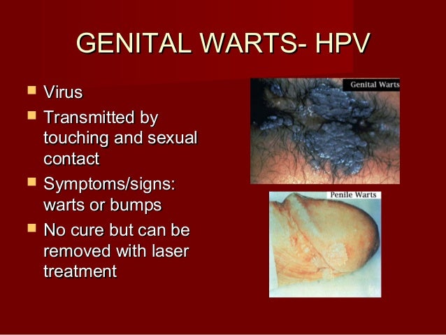 Sexually transmitted diseases that have no cure Sexually transmitted diseases that have no cure